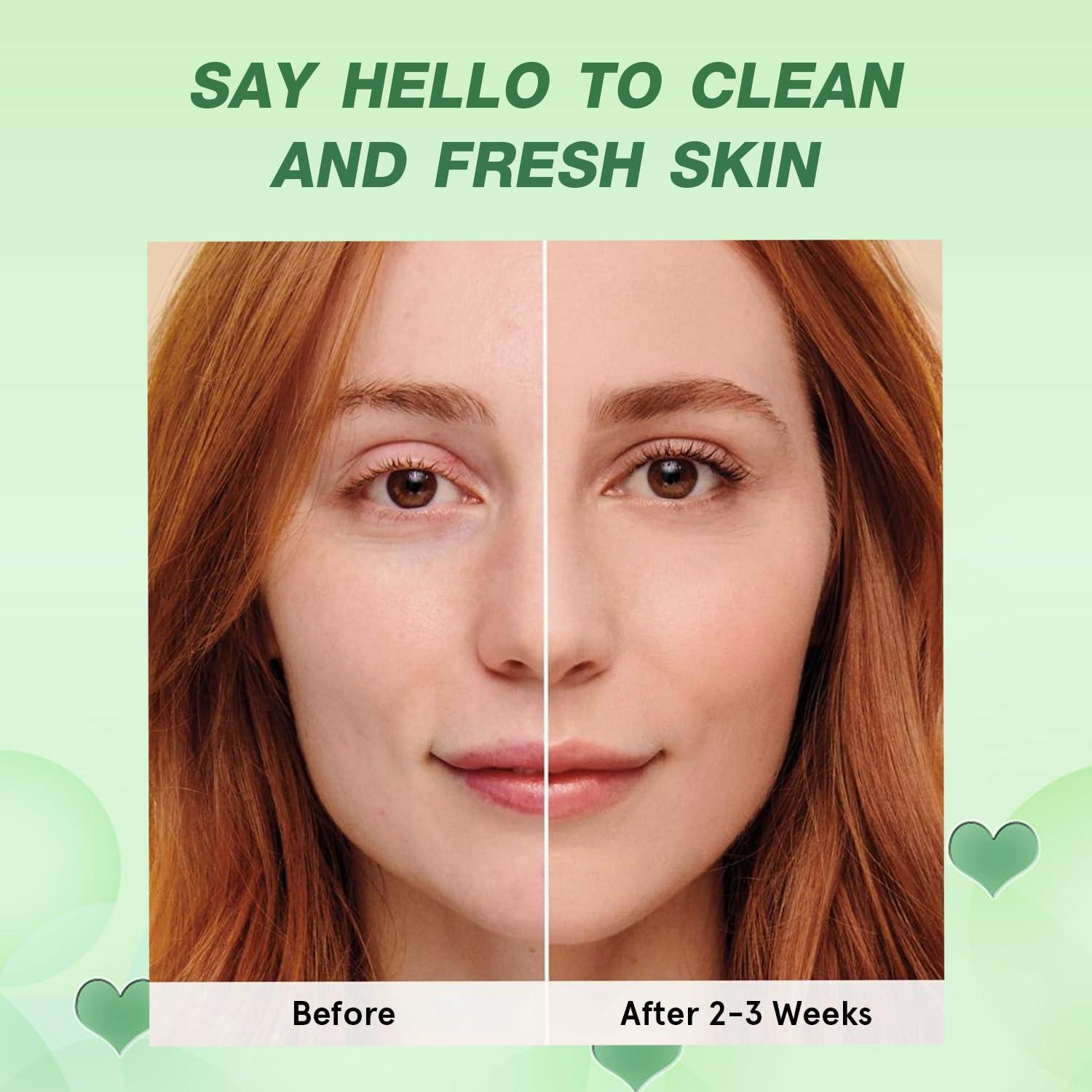 Mascarilla de Limpieza Profunda Josmon Té Verde 2PCS 160g