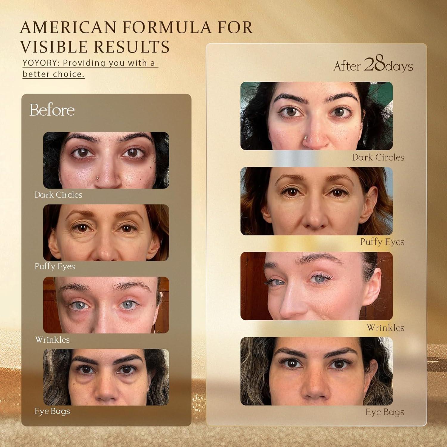 Crema para Ojos YOYORY con Retinol 20ml - Anti-Envejecimiento