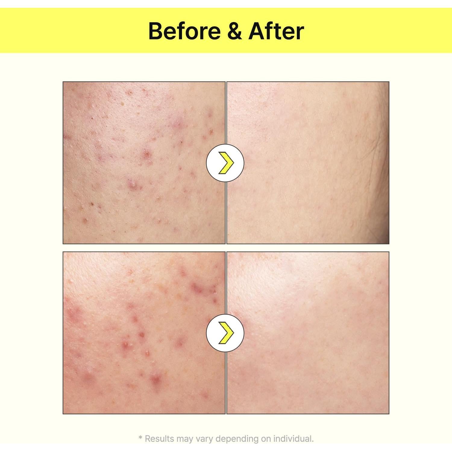 Suero Iluminador TIAM Vita B3 40 ml - 10% Niacinamida