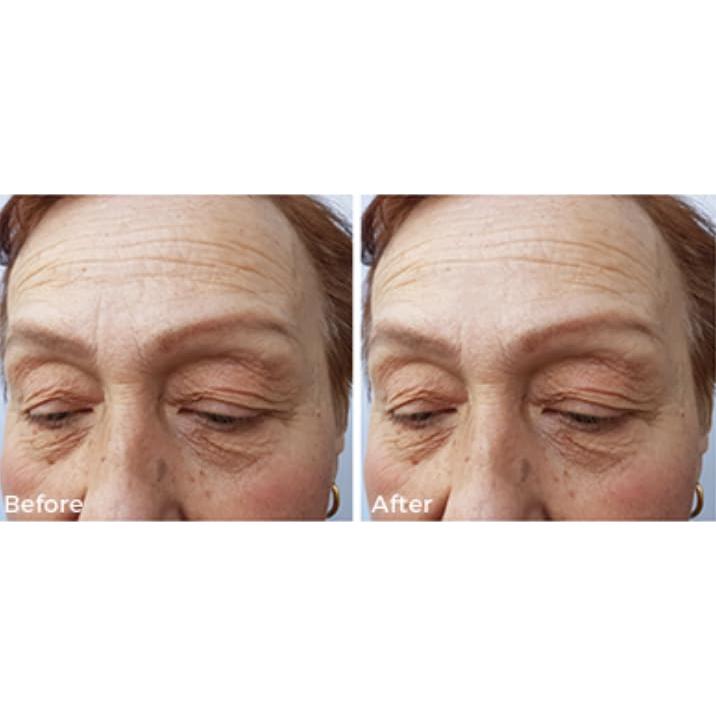 Suero de Colágeno Arianna Skincare 132g Hidratante Antienvejecimiento