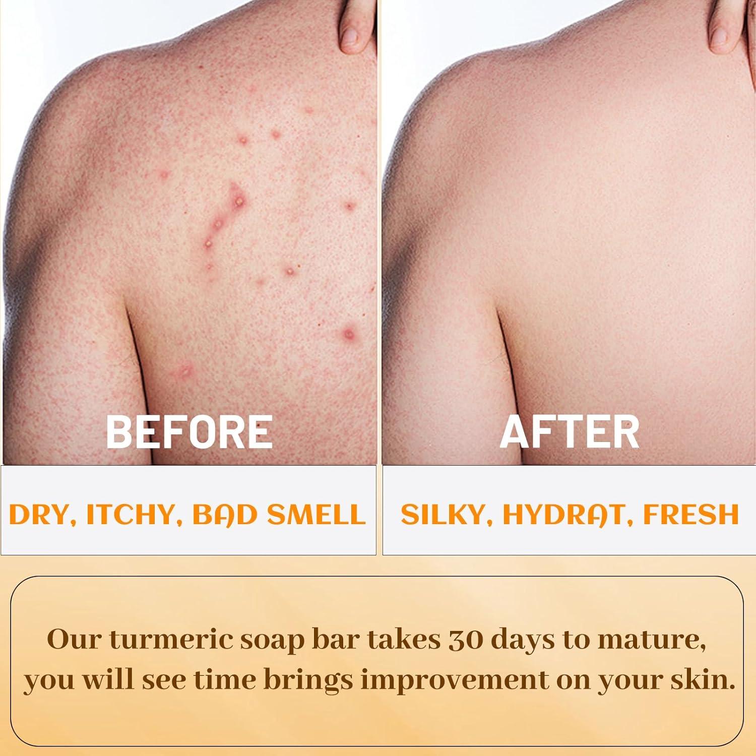 Jabón de Cúrcuma Orgánico Hecho a Mano 100g - Umpeimvon