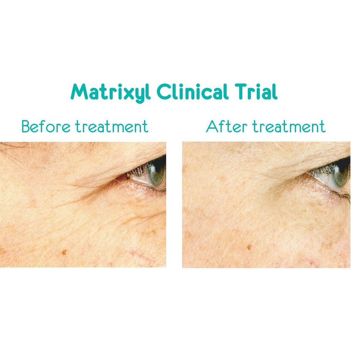 Crema Hidratante Antiarrugas Anavita 50 ml - Péptidos y Ácido Hialurónico