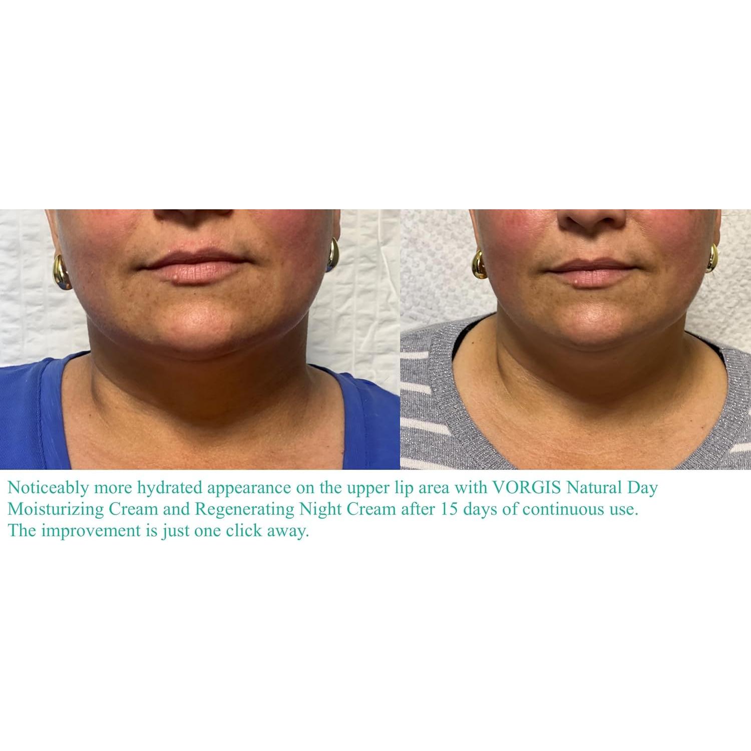 Crema Regeneradora Nocturna VORGIS NATURAL 96g Ácido Hialurónico