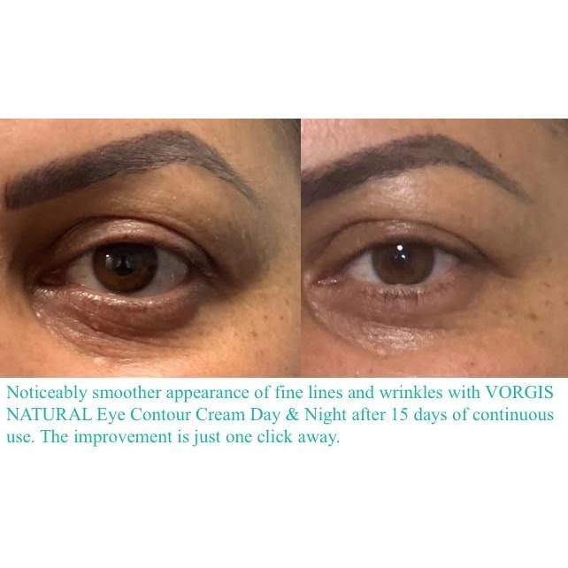 Crema Contorno de Ojos VORGIS NATURAL 15 ml Ácido Hialurónico