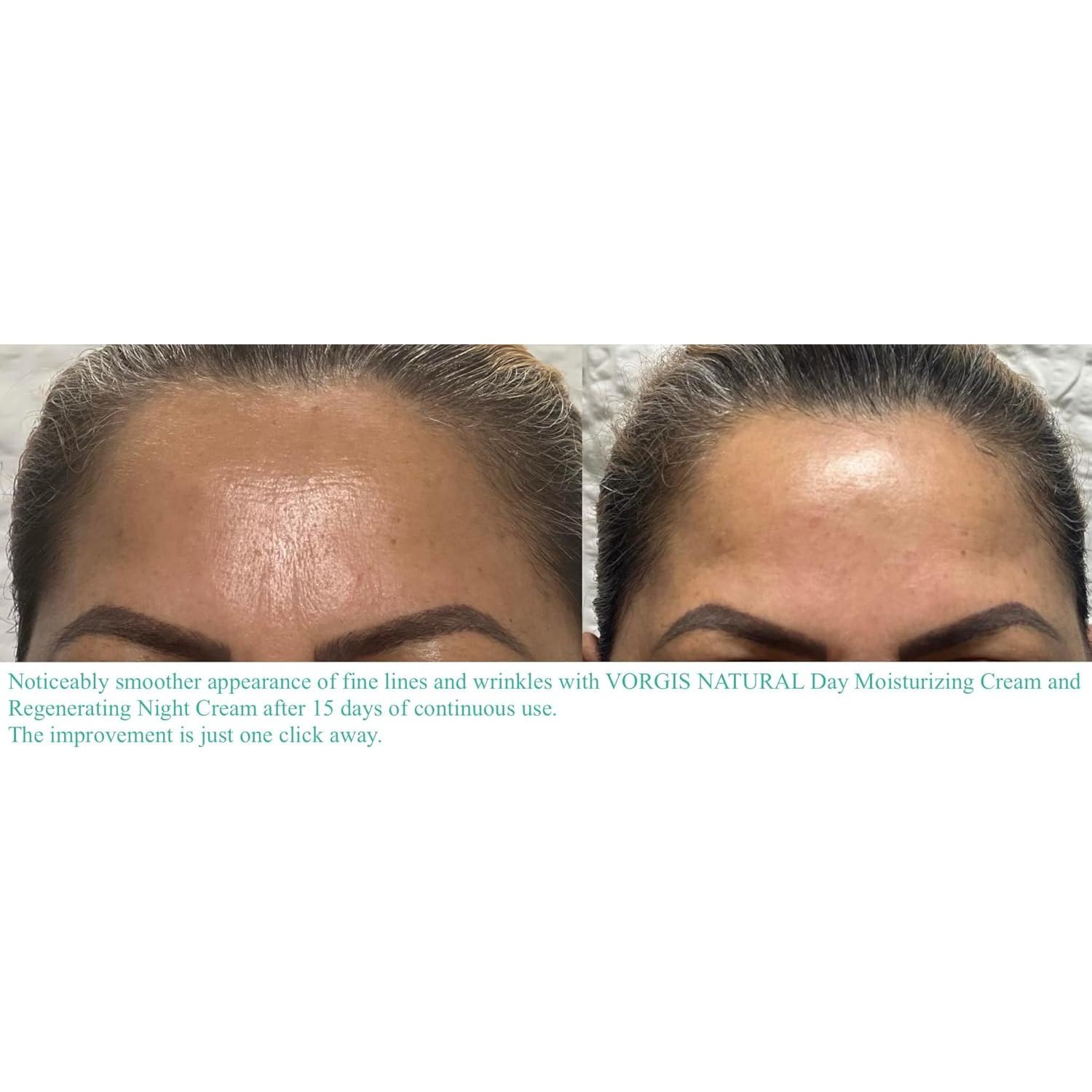 Crema Contorno de Ojos VORGIS NATURAL 15 ml Ácido Hialurónico