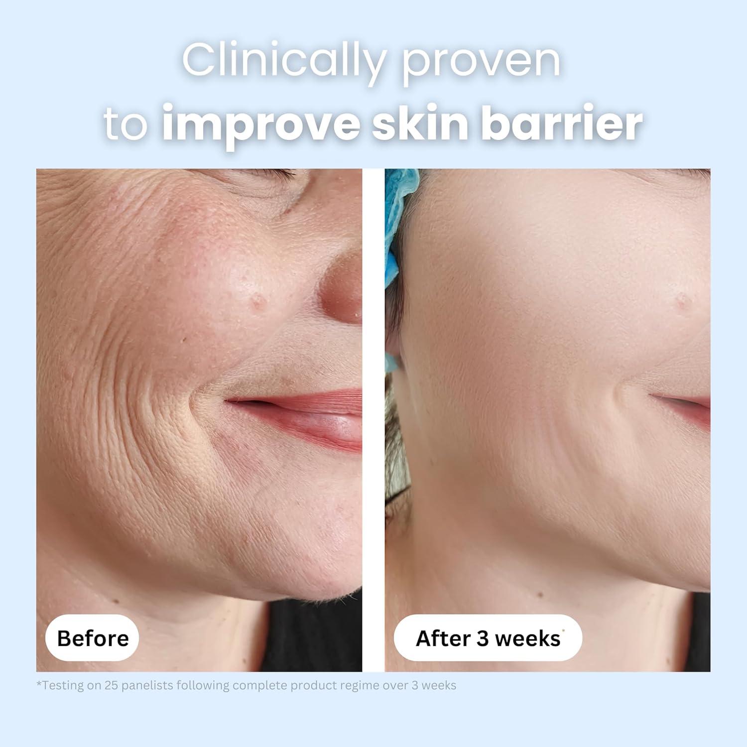 Crema Hidratante Anti-Envejecimiento New Pacific 56.7g Veneno de Abeja