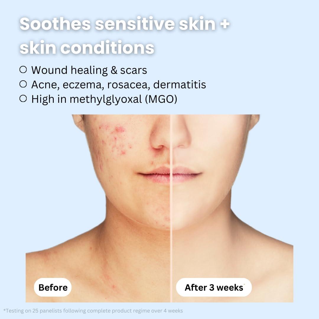 Crema Hidratante Anti-Envejecimiento New Pacific 56.7g Veneno de Abeja