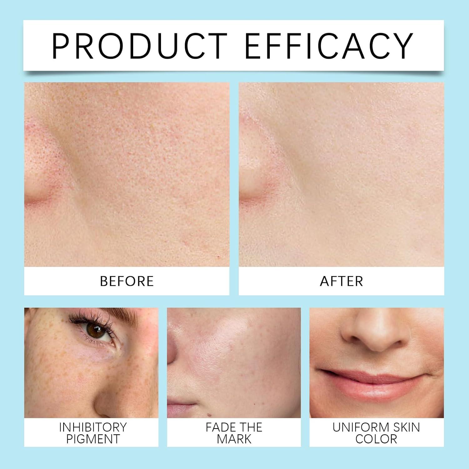 Tónico Hidratante Facial HOYGI 120 ml - Ácido Hialurónico