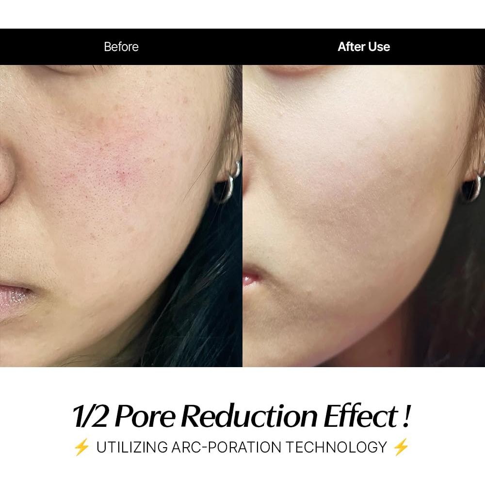 Set de Cuidado de Piel CELORABY Glow - Dispositivo 5-en-1 y Almohadillas