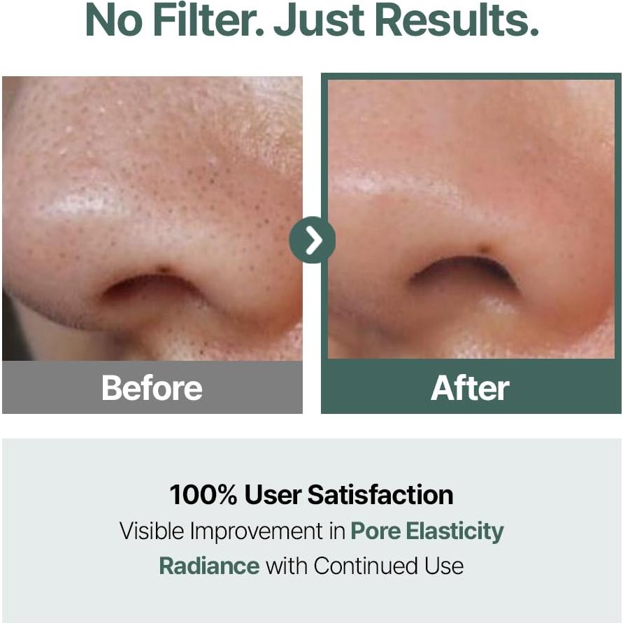 Set de Cuidado de Piel CELORABY Glow - Dispositivo 5-en-1 y Almohadillas