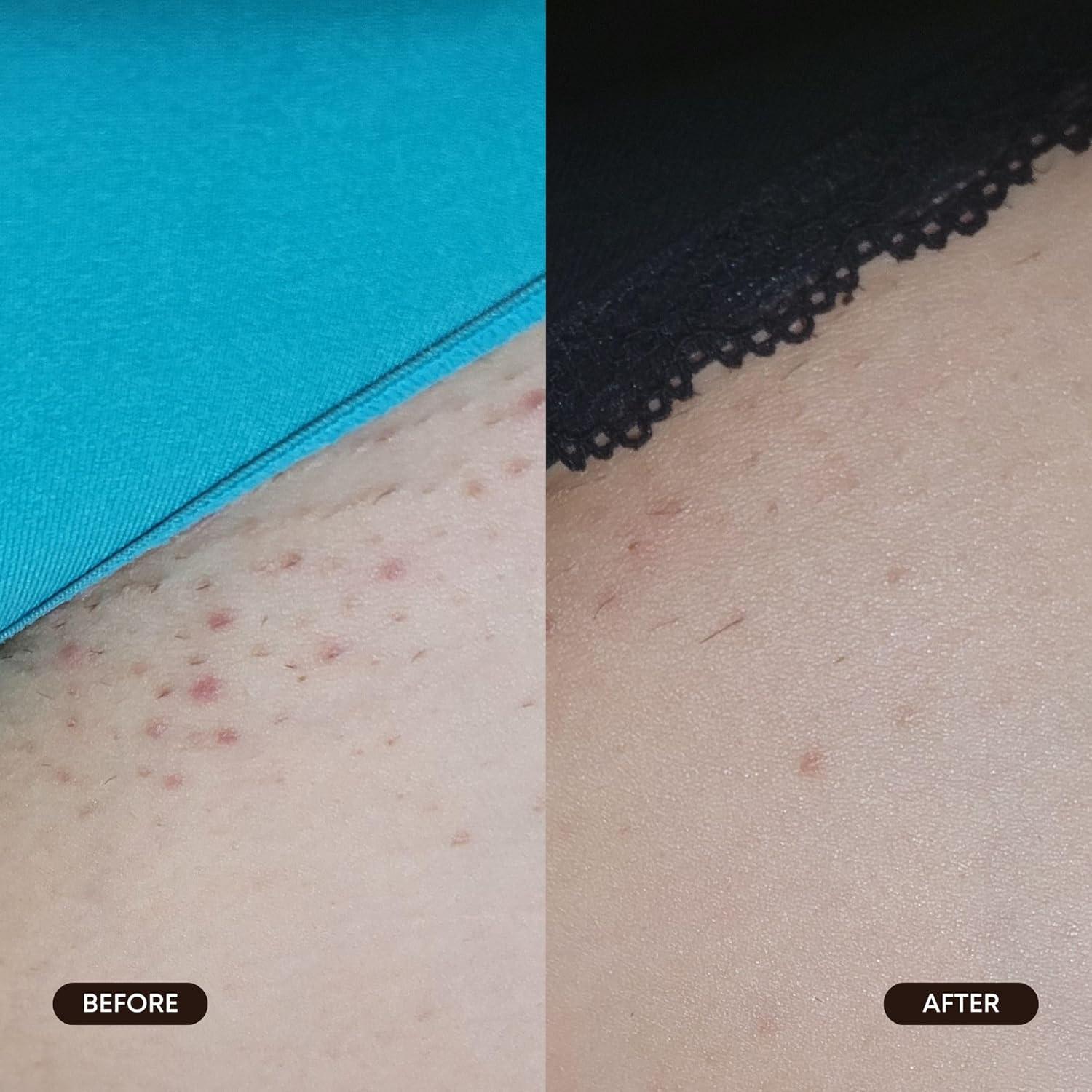 Almohadillas Exfoliantes Bushbalm Reinicio Radiante 30 Unidades