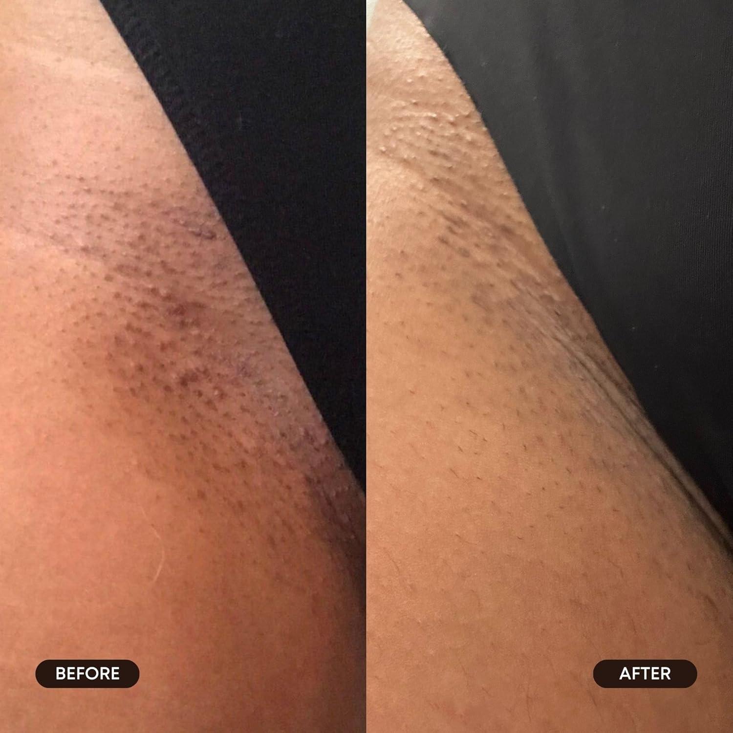 Almohadillas Exfoliantes Bushbalm Reinicio Radiante 30 Unidades