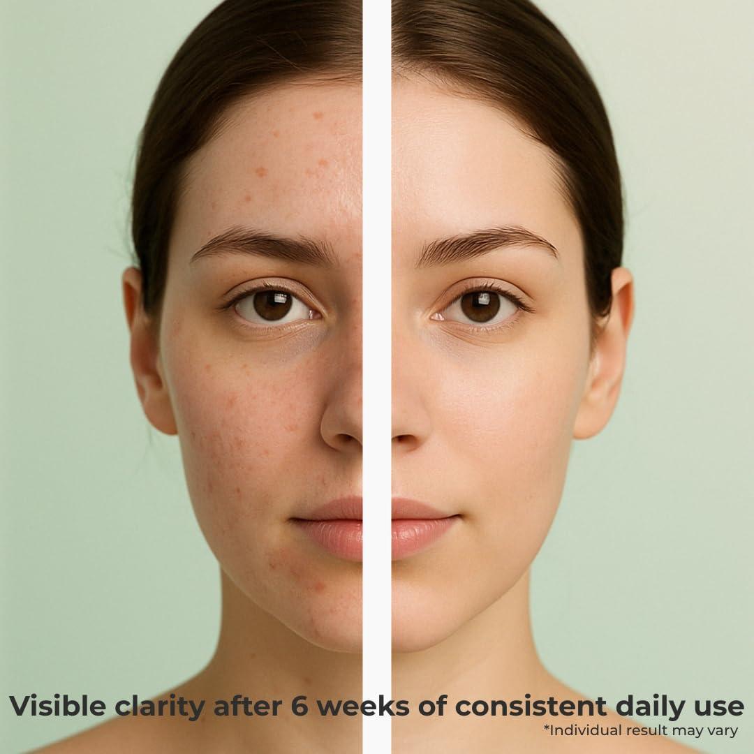 Gel Limpiador Exfoliante Vegano Insane Glow - 200ml - Ácido Hialurónico