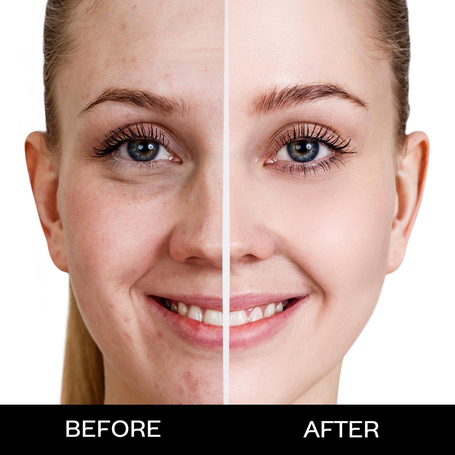 Base Mate Ligera FACESCANADA 15ml - Cobertura Completa Antienvejecimiento