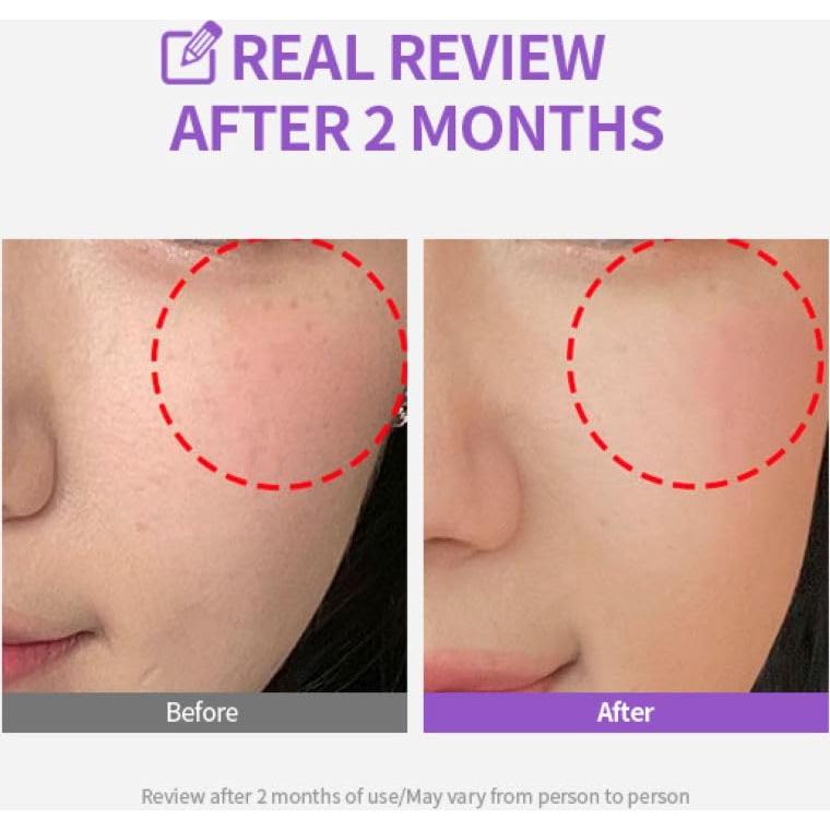 Crema Iluminadora Facial Meoru Podo Vita C 168g | Hidratante con Vitamina C, Niacinamida y Ácido Hialurónico