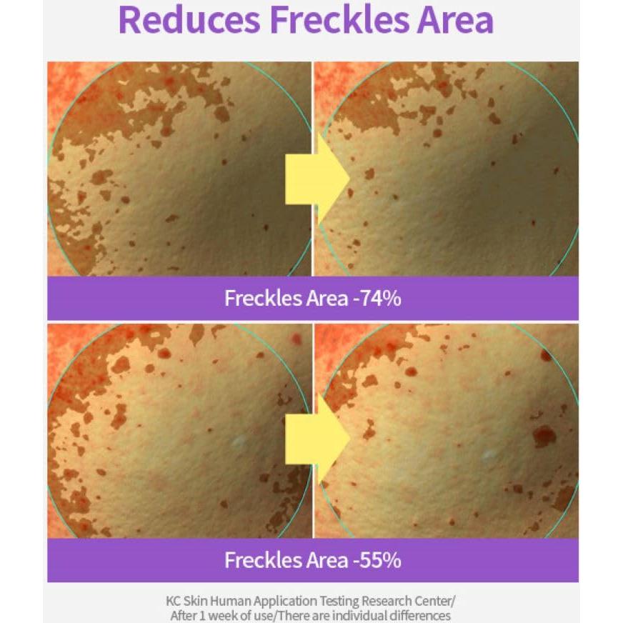 Crema Iluminadora Facial Meoru Podo Vita C 168g | Hidratante con Vitamina C, Niacinamida y Ácido Hialurónico