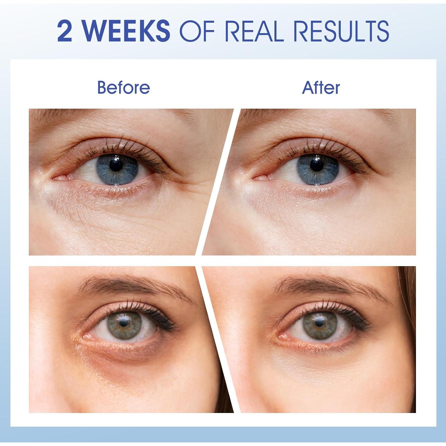 Crema para Ojos Antiarrugas Ceedoo con Ceramidas y Cafeína 14g