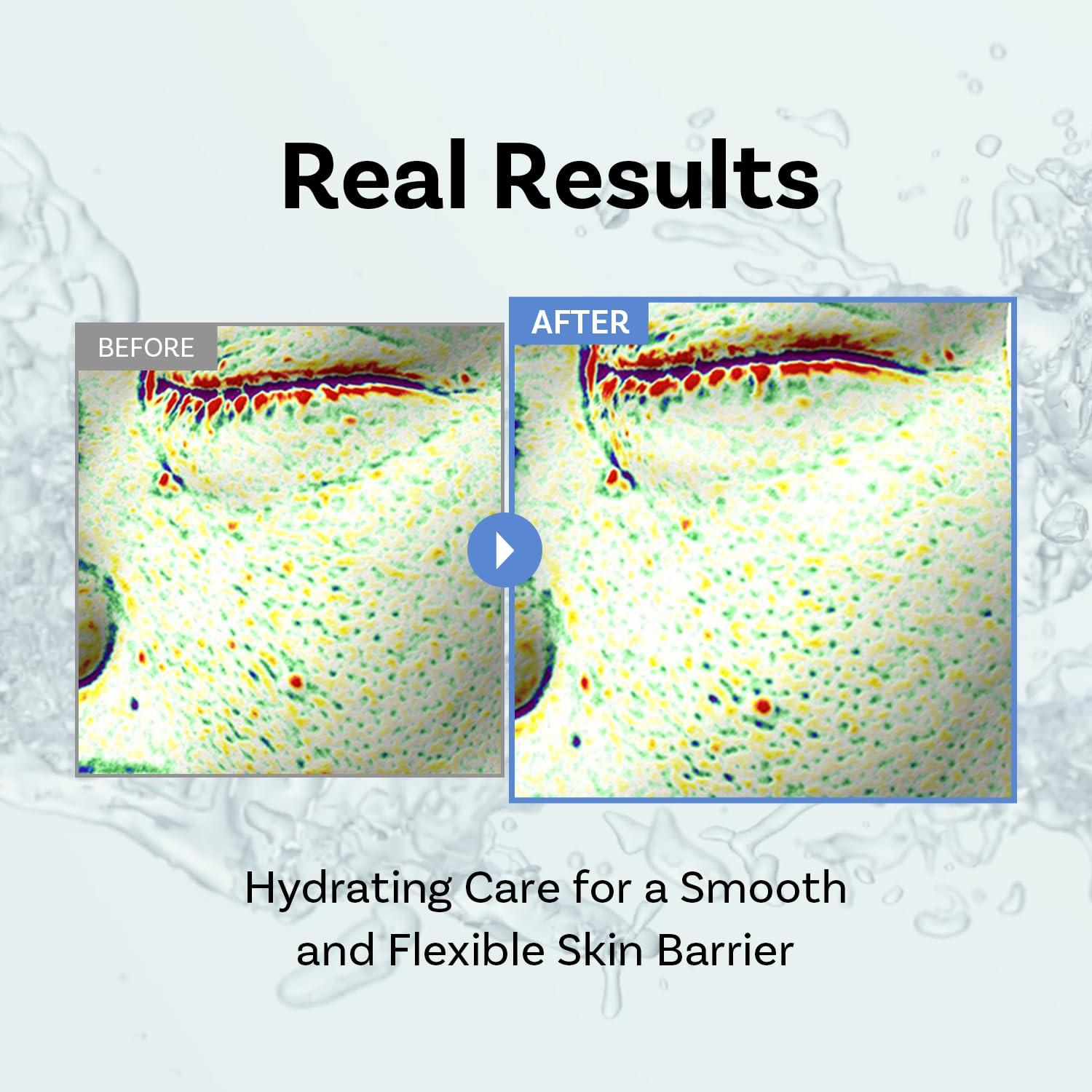 Crema Hidratante APOTHE Exosome Squal-Tox 100ml - Aclaradora