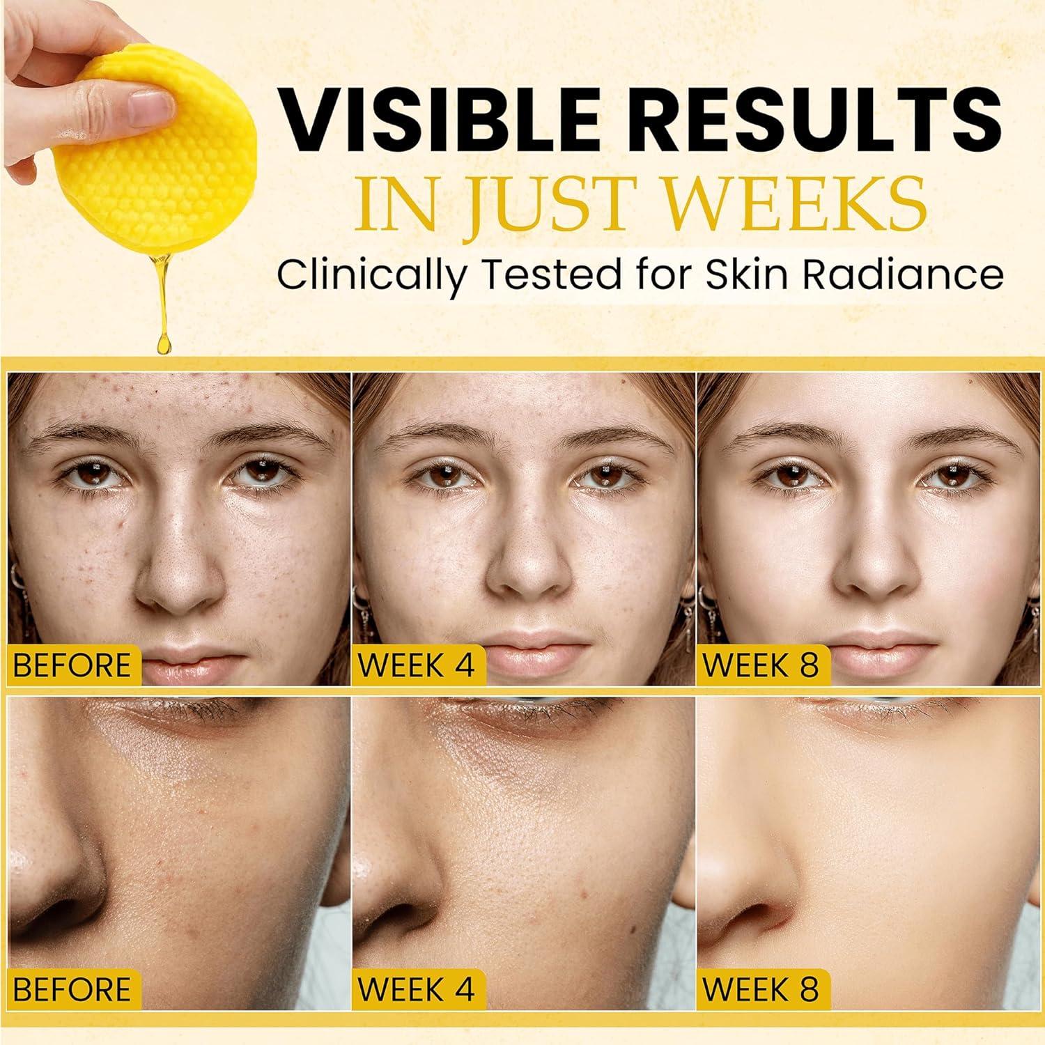 Pads de Limpieza Exfoliantes Dermatrue con Ácido Kojico y Cúrcuma - 80 Piezas