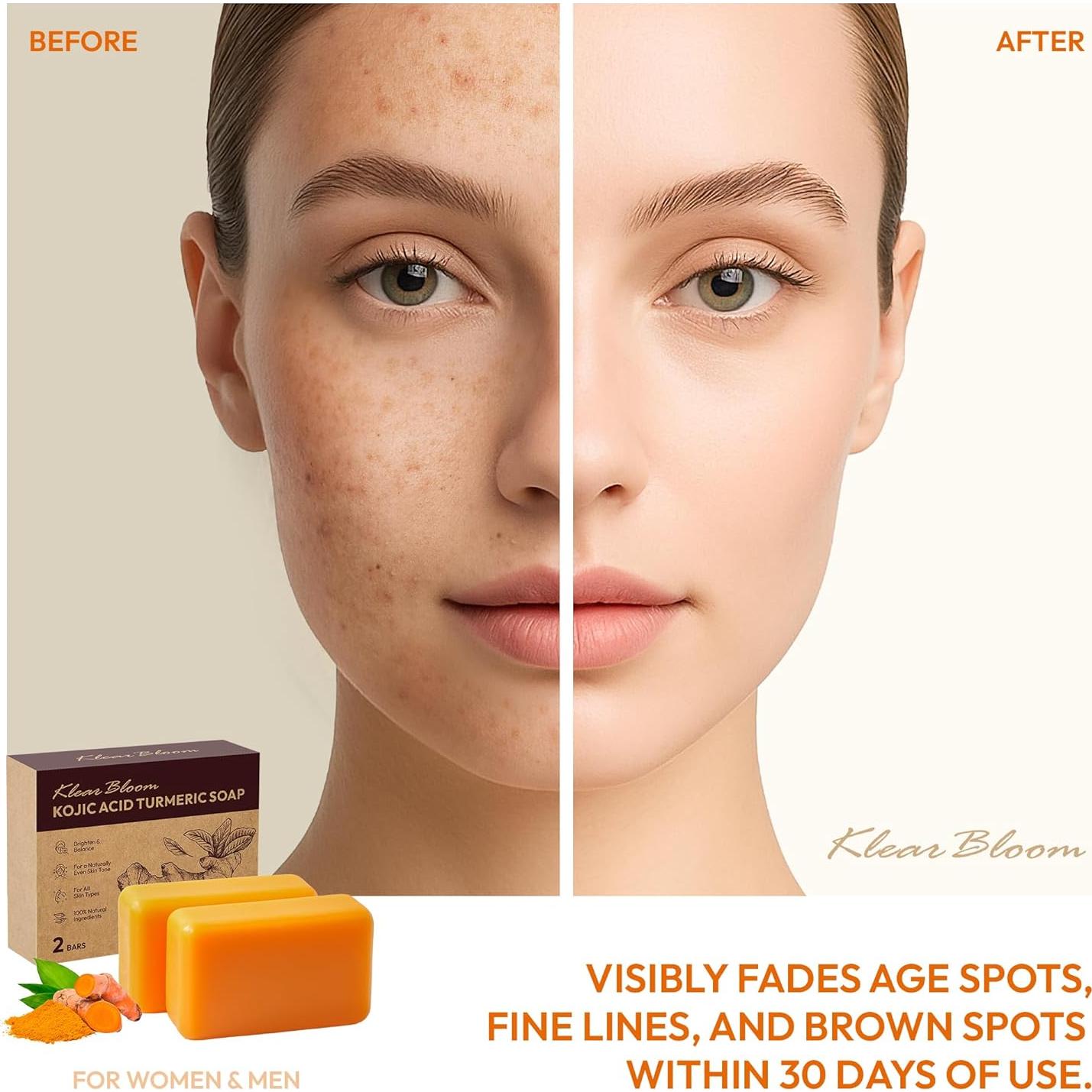 Jabón Aclarador KlearBloom con Ácido Kójico y Cúrcuma 210g