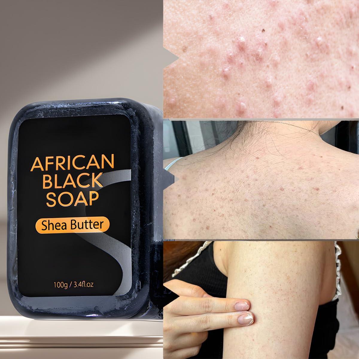 Jabón Negro Africano en Barra 4 Unidades - Manteca de Karité