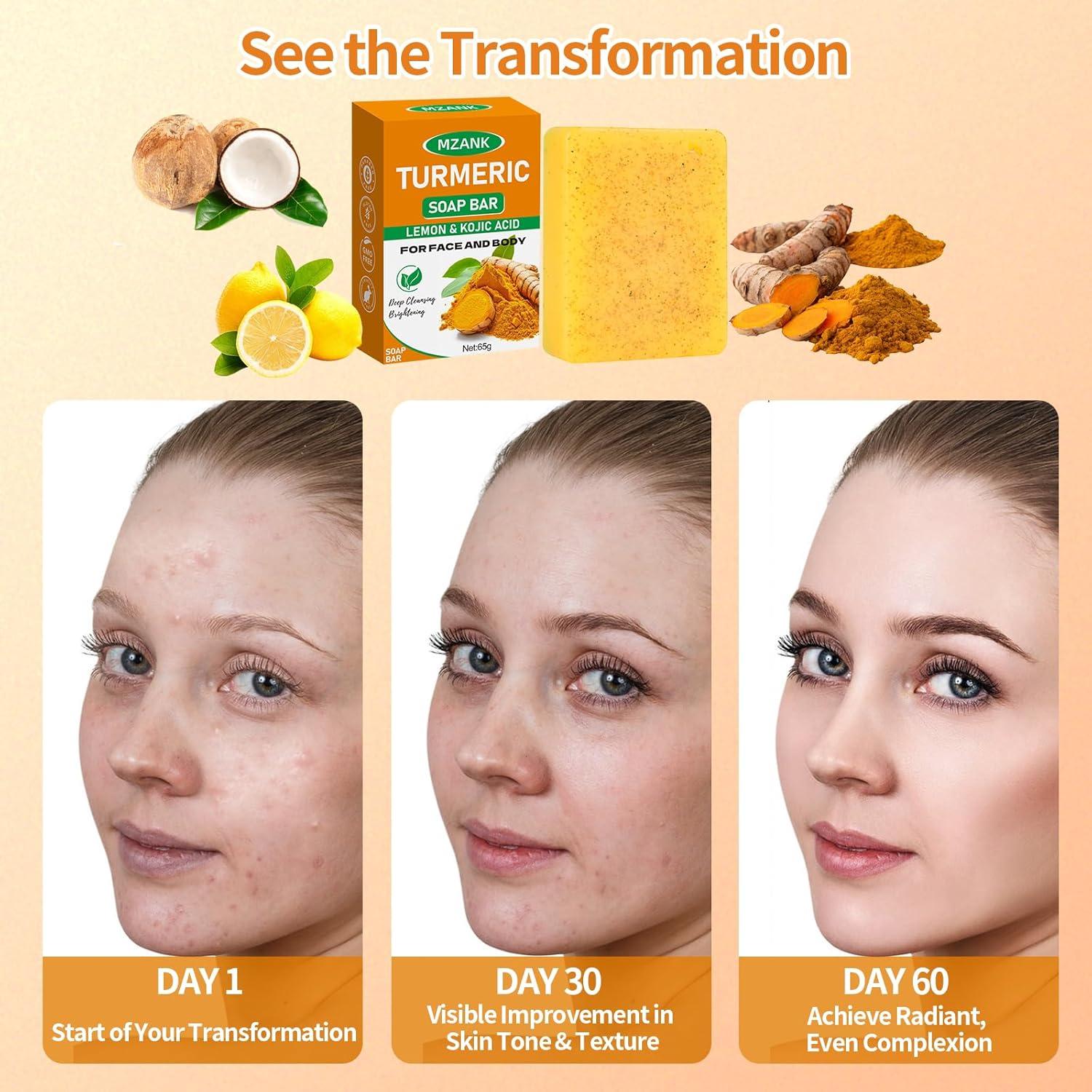 Jabón Aclarante de Cúrcuma MZANK - 100g para Manchas Oscuras
