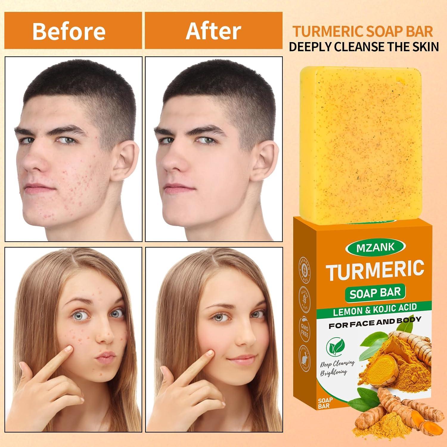 Jabón Aclarante de Cúrcuma MZANK - 100g para Manchas Oscuras