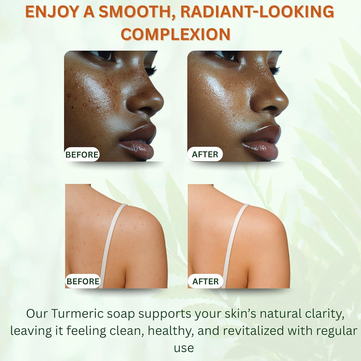 Barra de Jabón de Cúrcuma PHAAMESTIC - Hidratante y Exfoliante