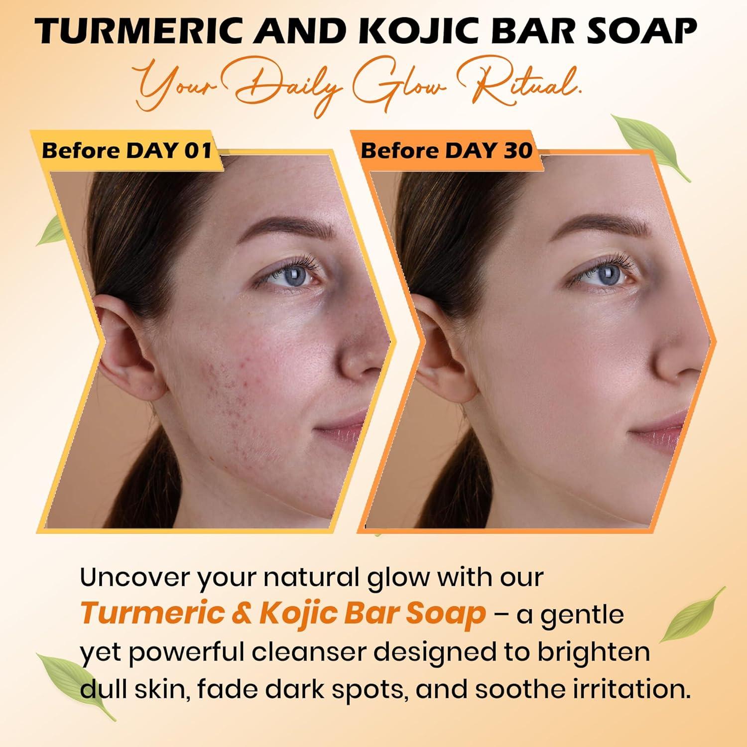 Jabón de Cúrcuma Kojic Balemalik 150g - Unifica Tono Piel