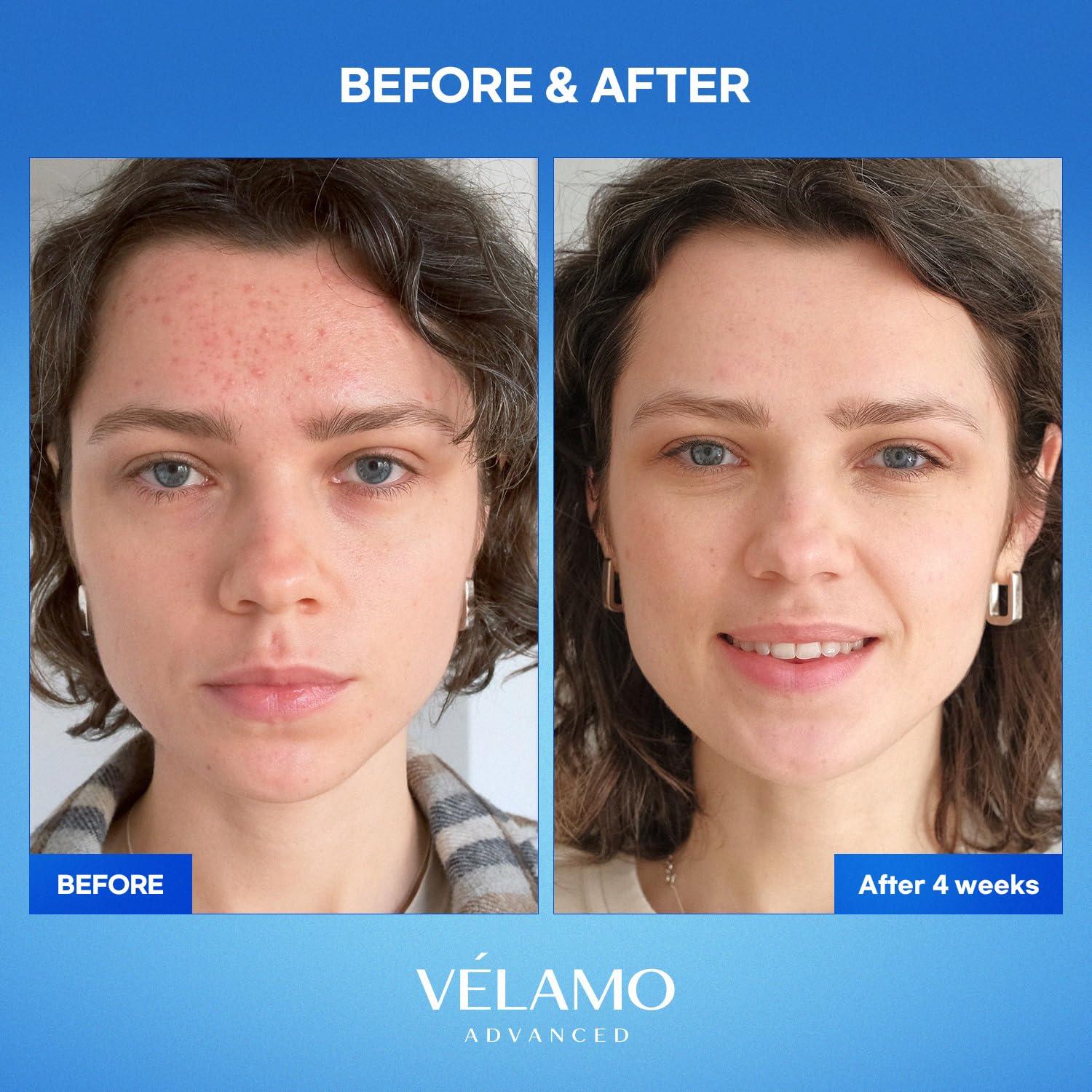 Suero Corrector de Manchas Oscuras VELAMO AVANZADO 30ml