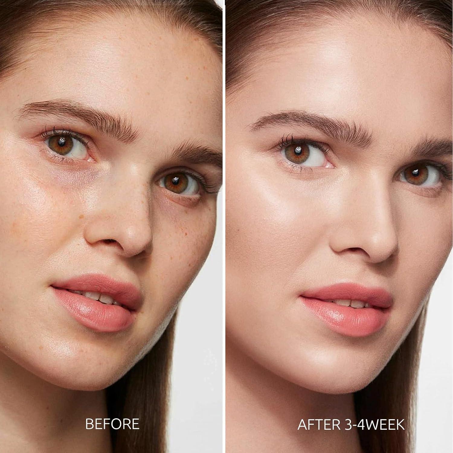 Suero Corrector de Manchas Oscuras Aurivoy 50 ml - Hidratante