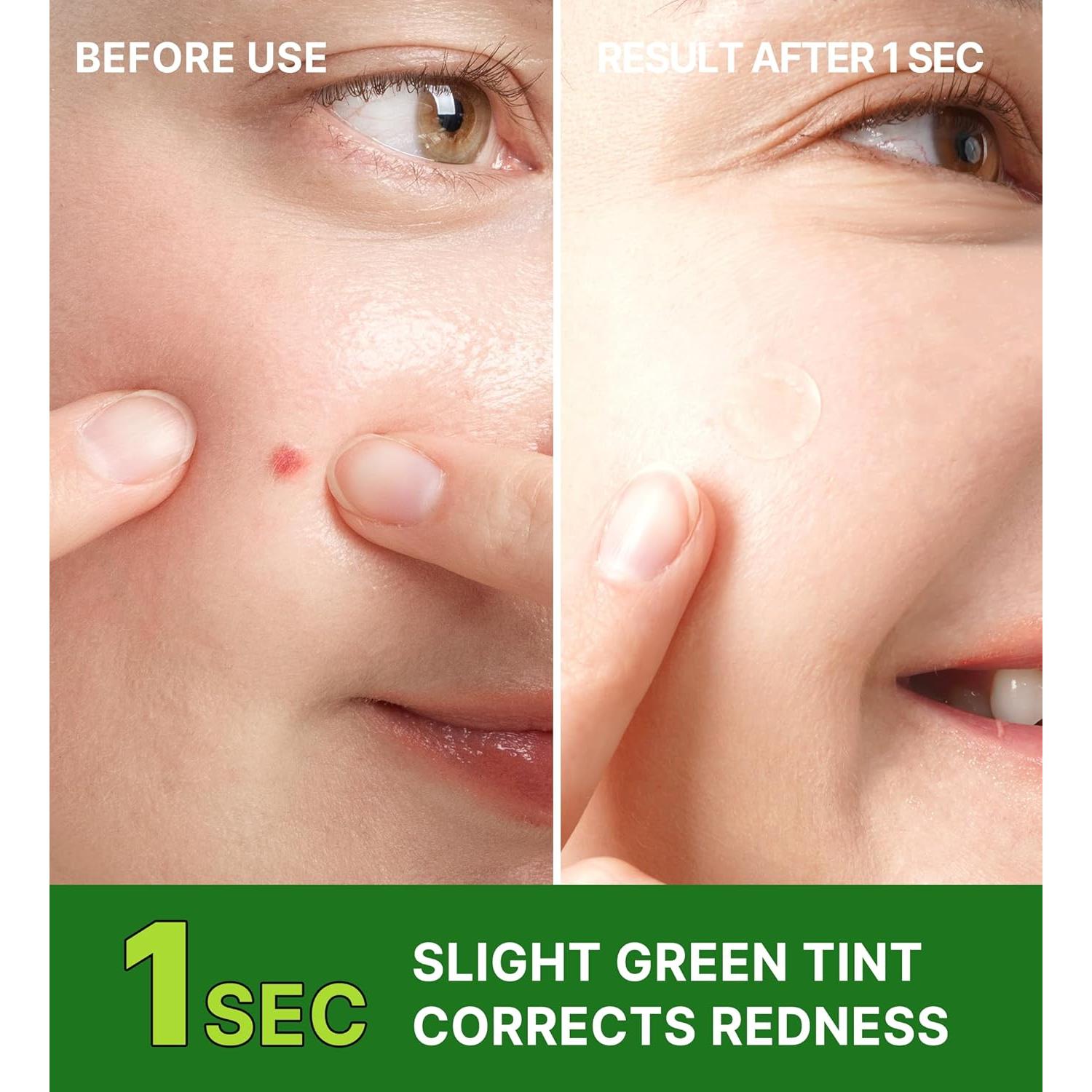 Parche Hidrocoloide Troubless para Granitos - 96 Unidades