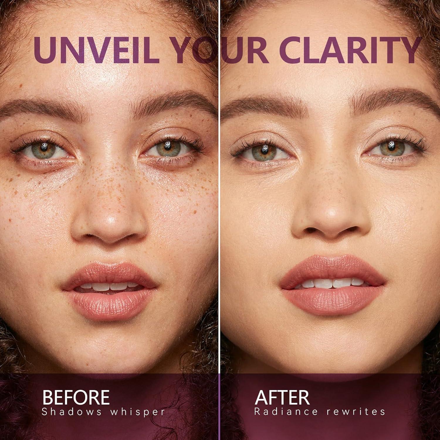 Suero Aclarador de Manchas Oscuras YVTYVT 20 ml con Bola Rodante