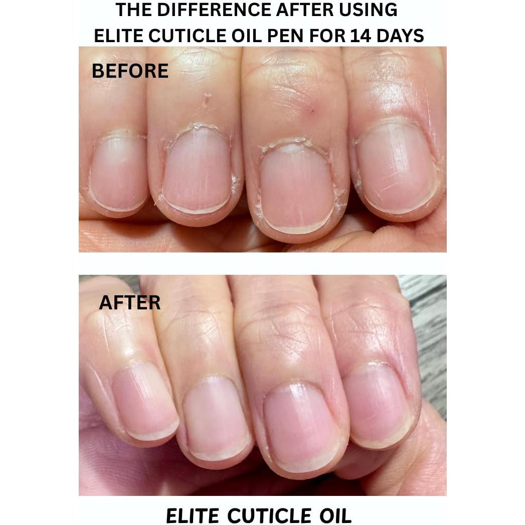 Bolígrafo Aceite para Cutículas Elite Naranja 17g Hidratante