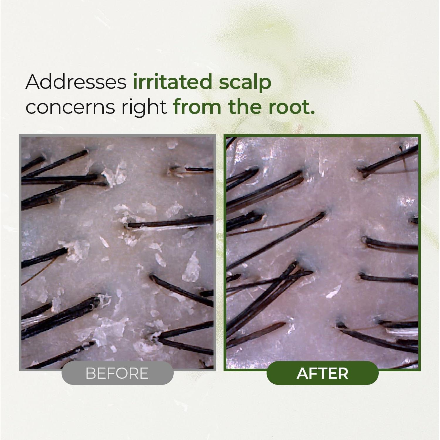 Exfoliante de Cuero Cabelludo STEAMBASE 50 ml - Agua de Árbol de Té