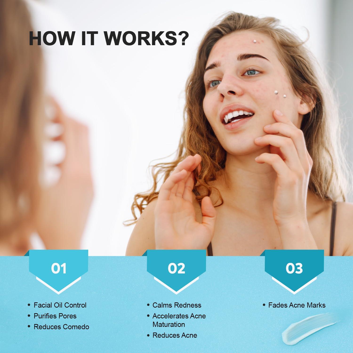 Crema Anti-Acné Enaskin Naturals 51 g - 10% Ácido Azelaico