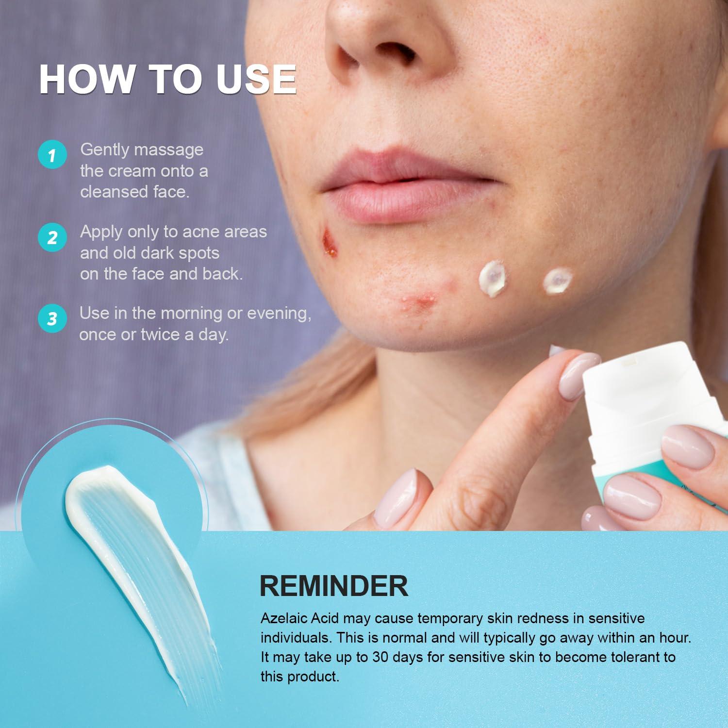 Crema Anti-Acné Enaskin Naturals 51 g - 10% Ácido Azelaico