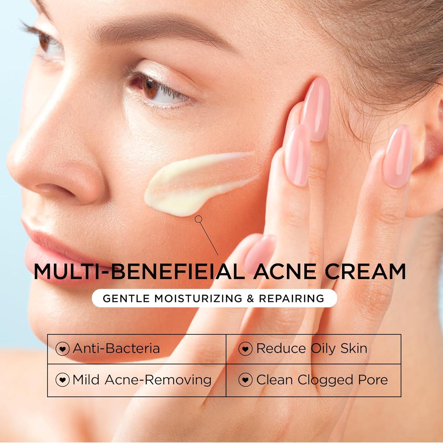 Crema Tratamiento Acné Quístico BellamiLuxx 149g - Hidratante Anti-Acné