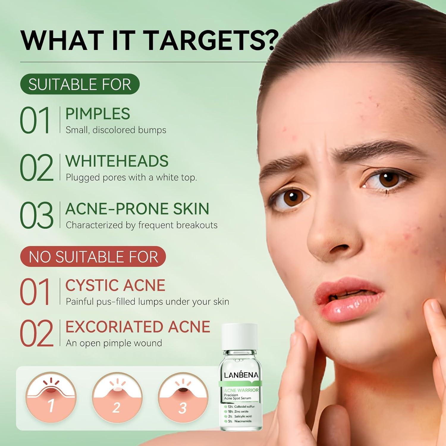 Suero Secante para Acné LANBENA 12.4 ml - Tratamiento Nocturno