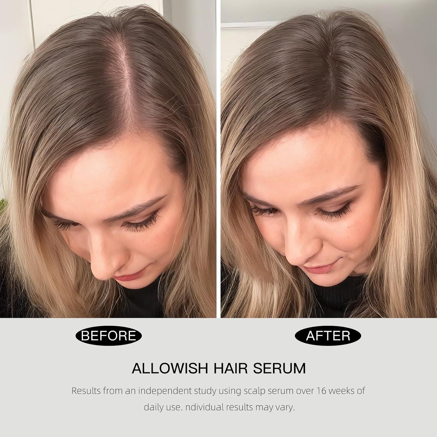 Suero Engrosante para el Crecimiento del Cabello Allowish 95 ml - Con Biotina y Cafeína