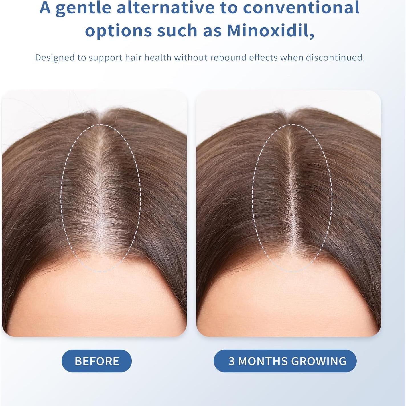 Suero Crecimiento Cabello QGGQ 30ml Roll-On Sin Enjuague