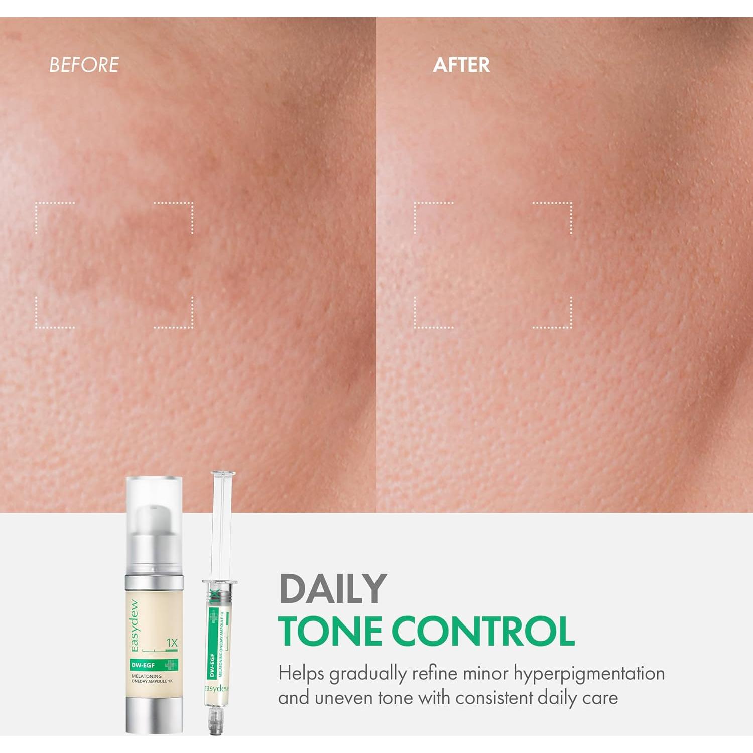 Suero Hidratante Easydew DW-EGF 30 ml con Niacinamida y Glutatión