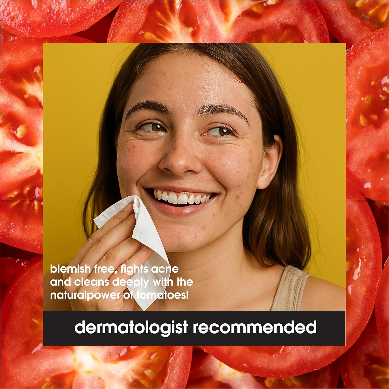 Toallitas Faciales Sí A Los Tomates 30 Unidades - Acné Control