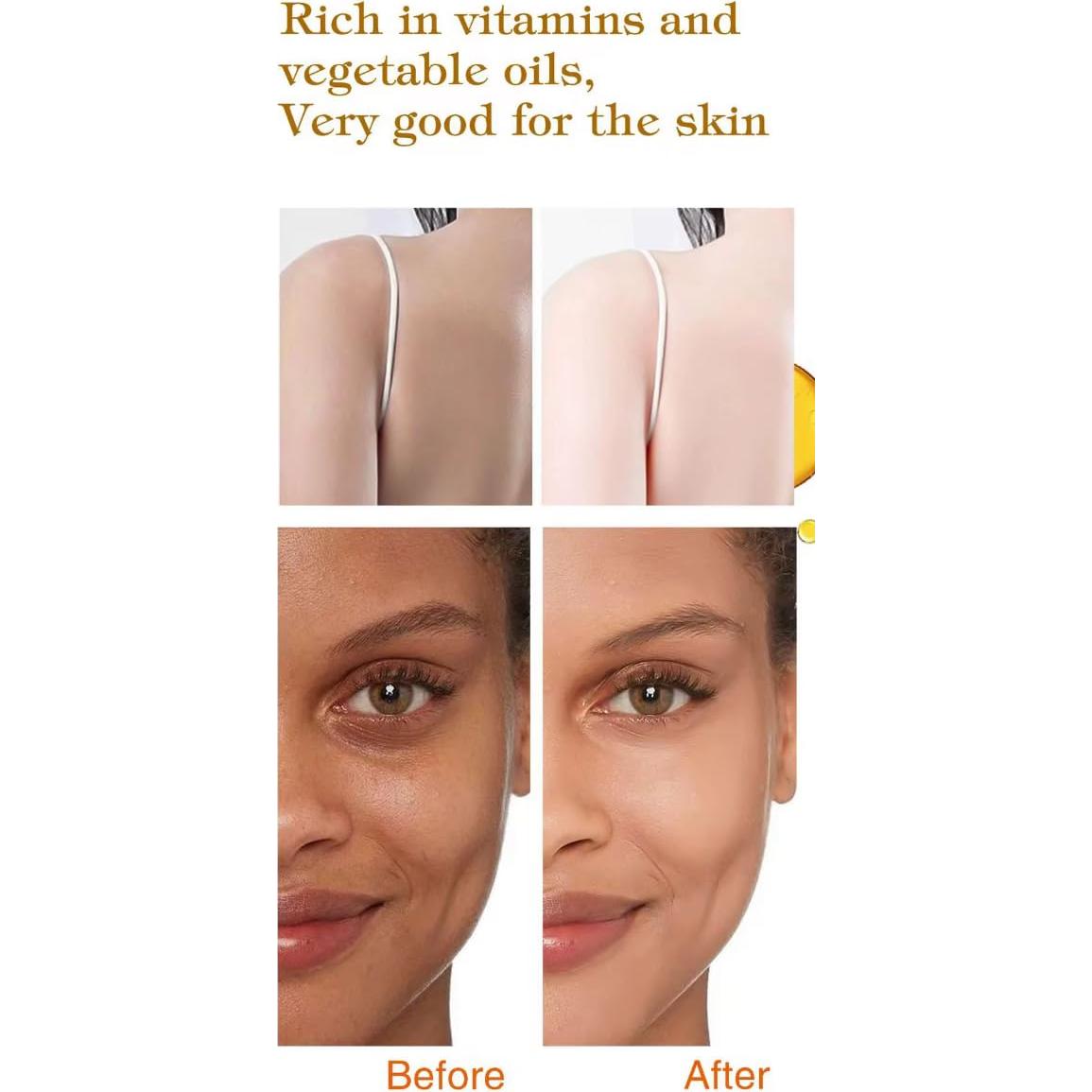 Jabón CARROT Soft 7 - Tratamiento Natural para Manchas 246g