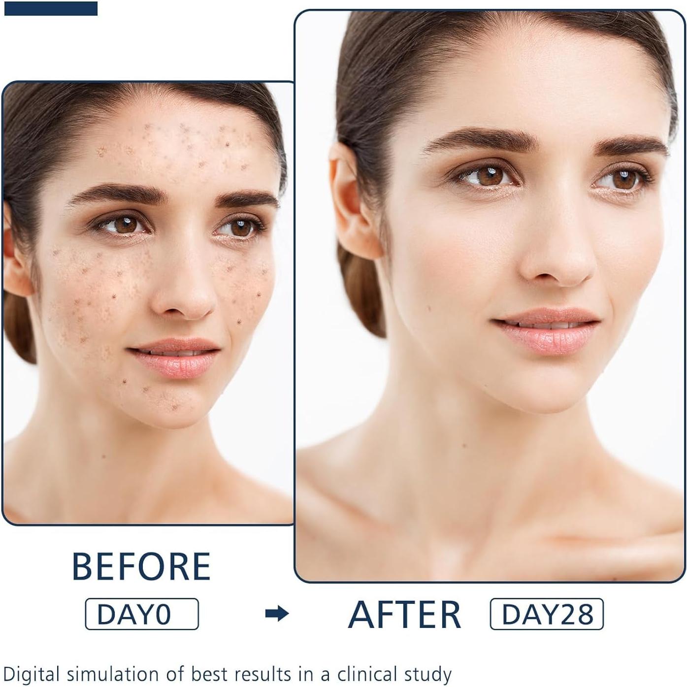 Suero Corrector de Manchas Oscuras SNFAJOHE 19.8 ml