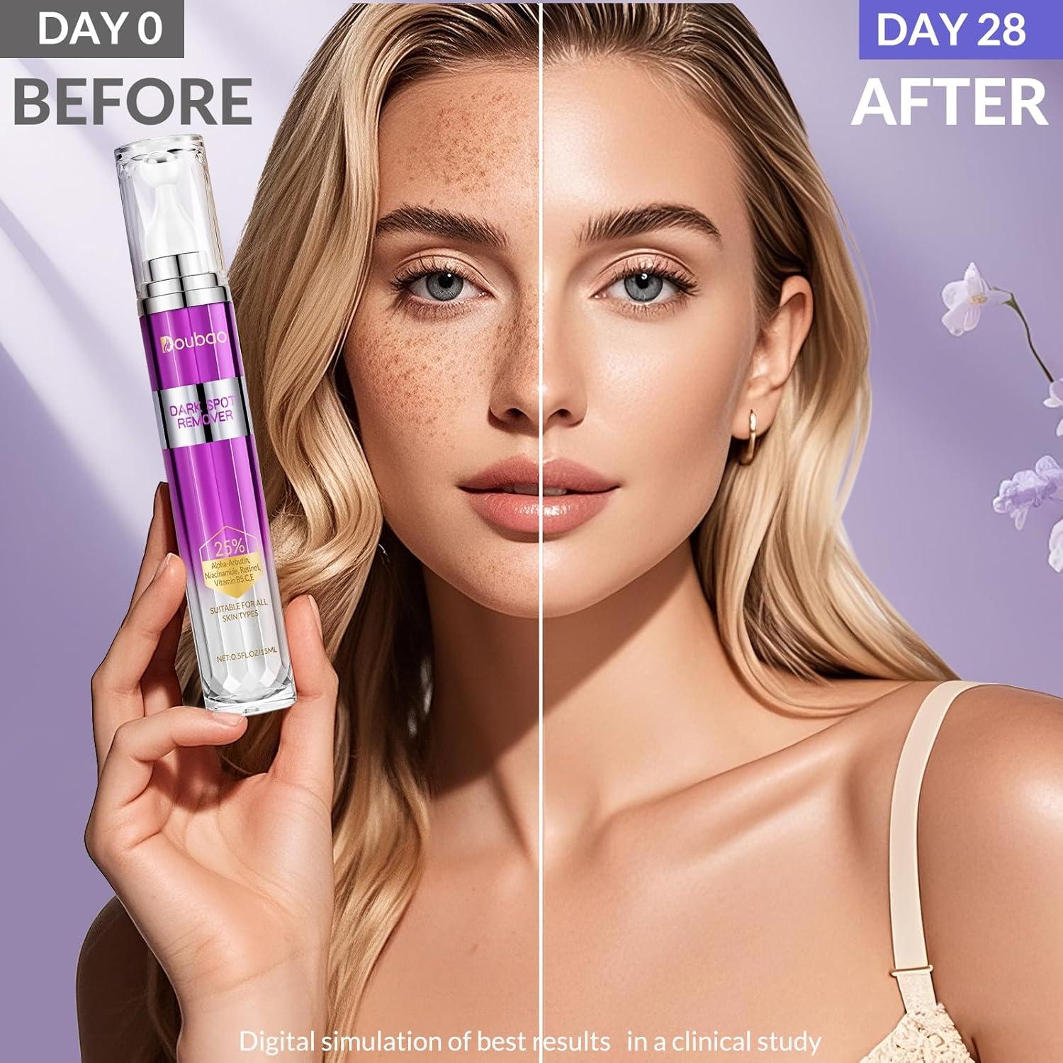 Suero Removedor de Manchas Oscuras Doubao 15 ml - Retinol