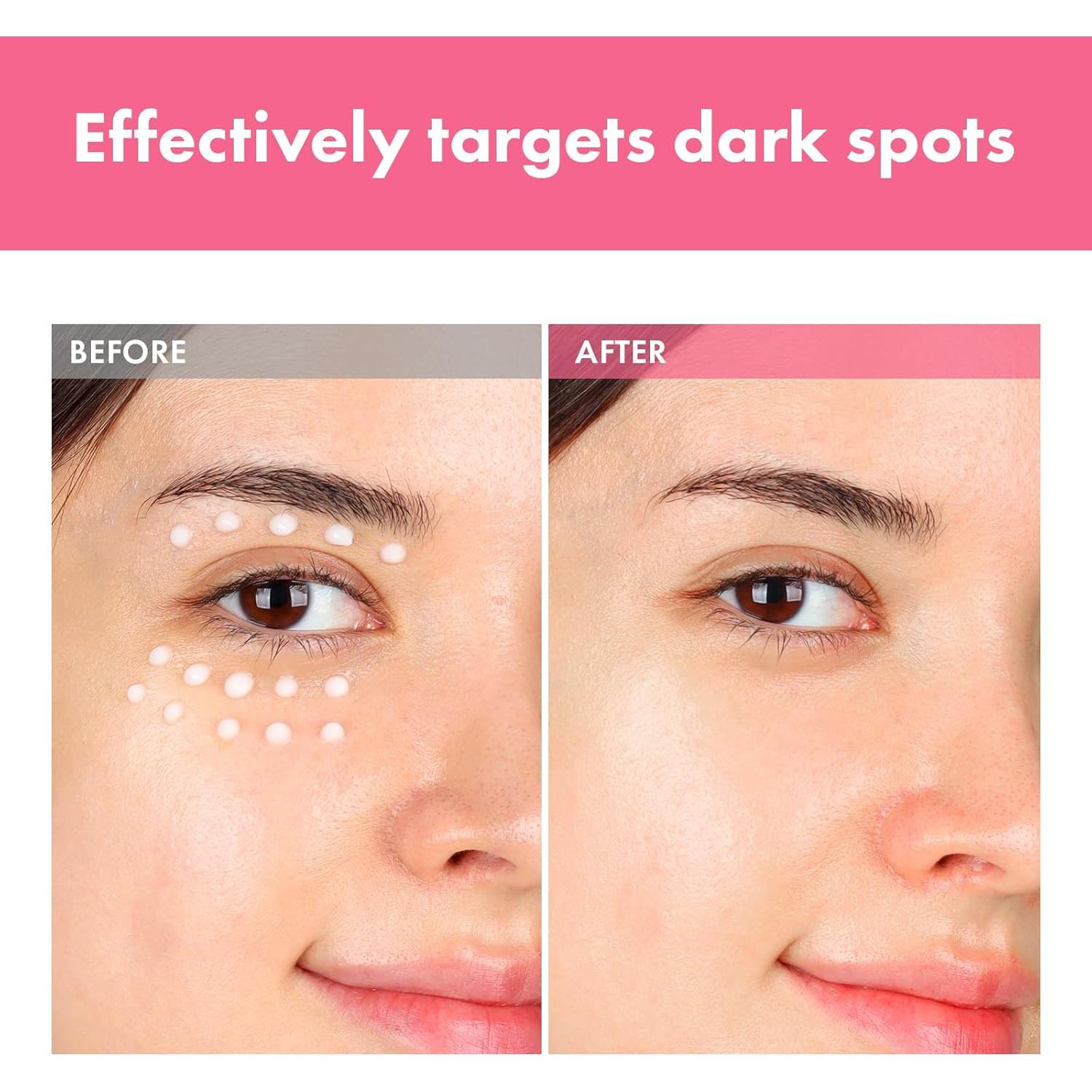 Crema Intensiva para Manchas Tosowoong 20ml - 7% Arbutina