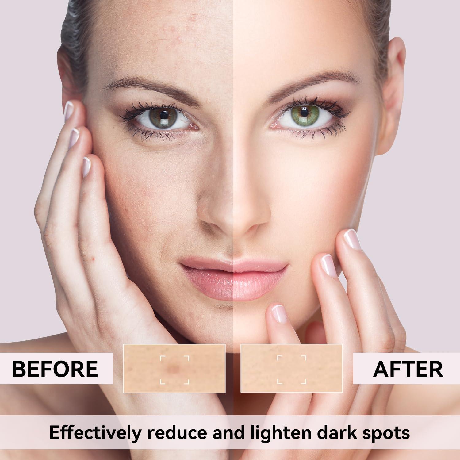 Removedor de Manchas Oscuras DMYGO 50 ml con Vitamina C