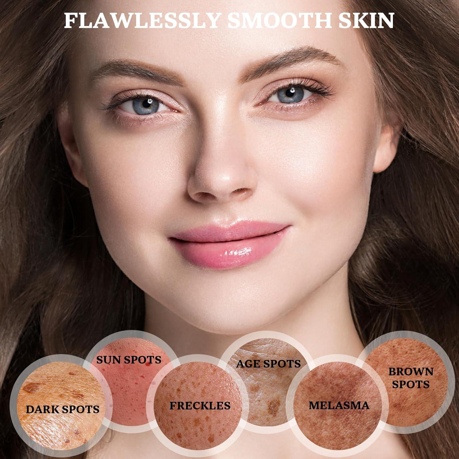 Crema Correctora de Manchas Oscuras CHEOKINGBA 50 ml