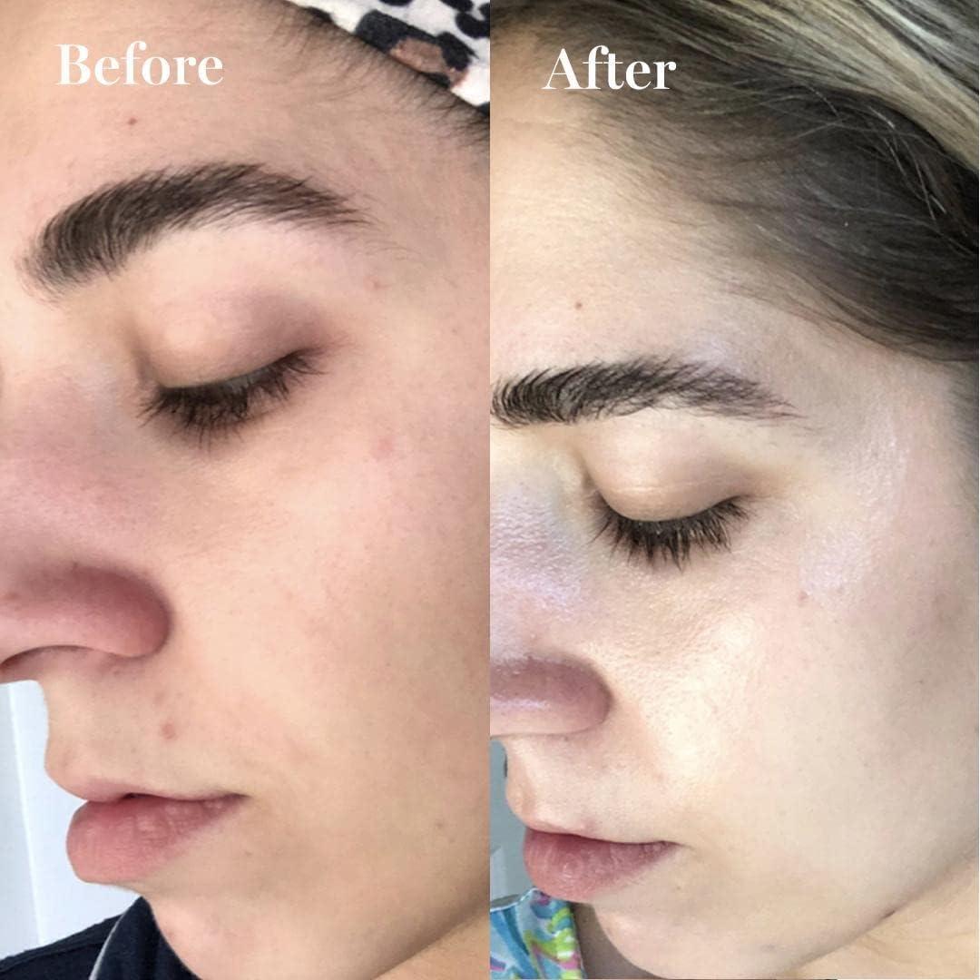 Crema Hidratante Facial Saturday Skin con Niacinamida y Ceramidas